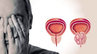 Veselīga un iekaisusi prostata